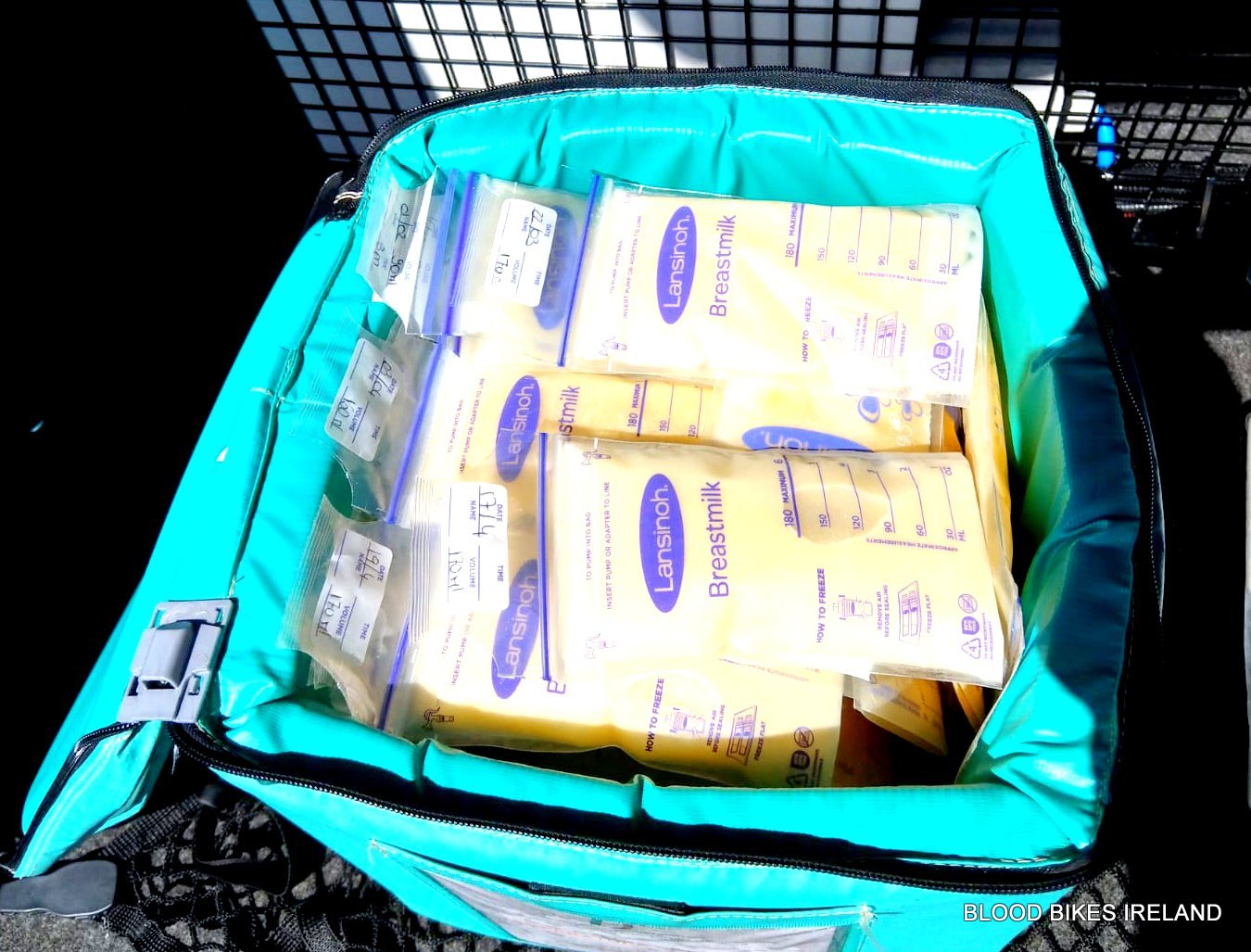 Human Donor Milk
